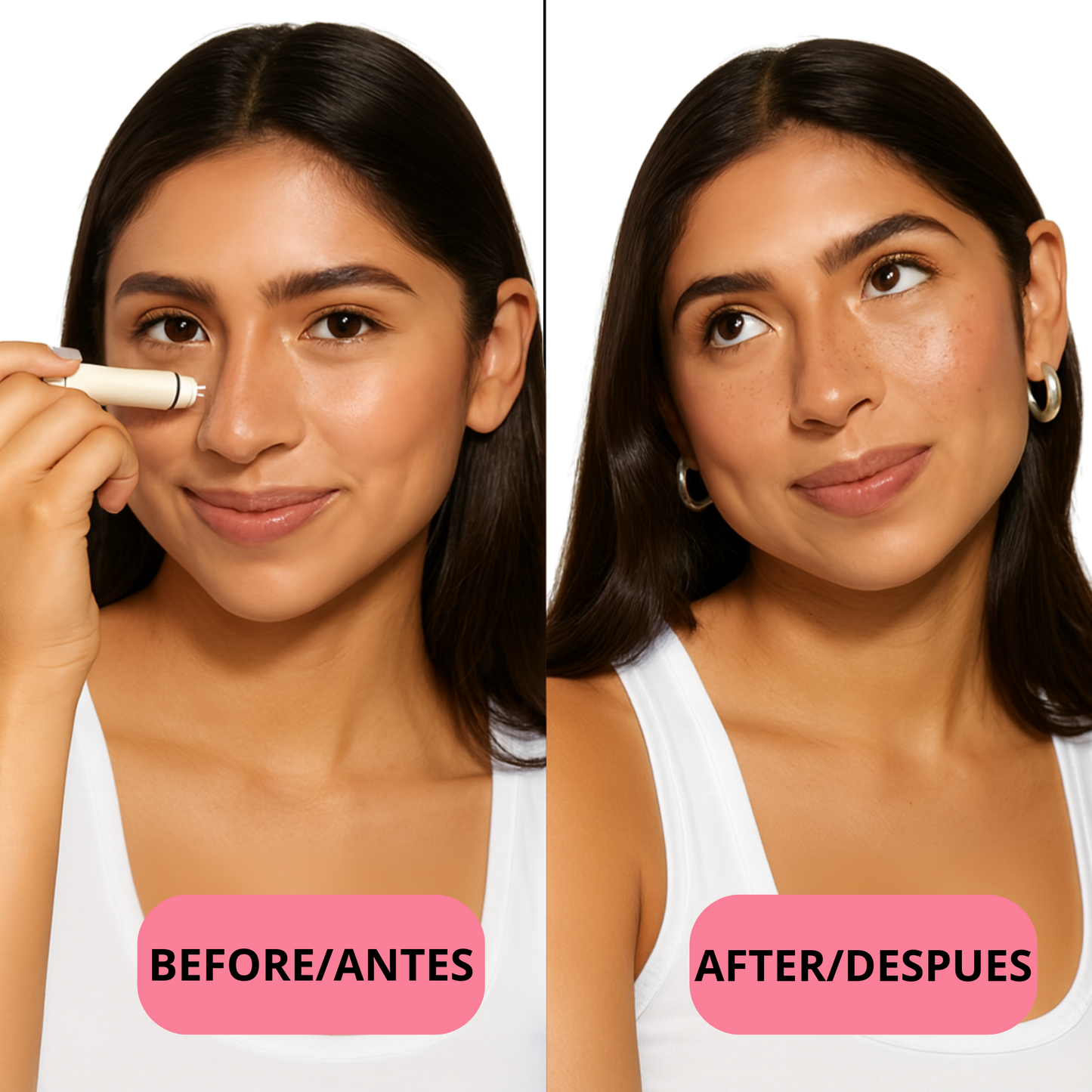 Sello de Pecas Natural 5-en-1